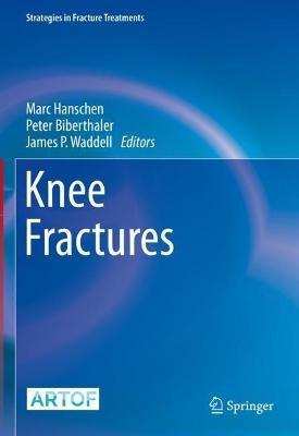 Knee Fractures - cover