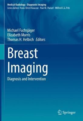 Breast Imaging: Diagnosis and Intervention - cover