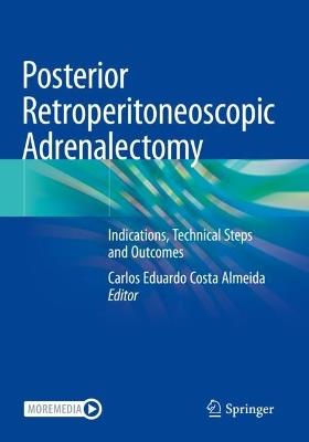 Posterior Retroperitoneoscopic Adrenalectomy: Indications, Technical Steps and Outcomes - cover