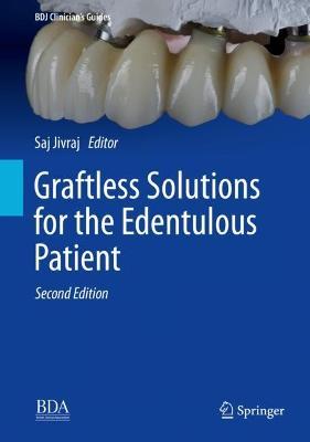 Graftless Solutions for the Edentulous Patient - cover
