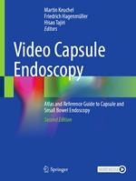 Video Capsule Endoscopy