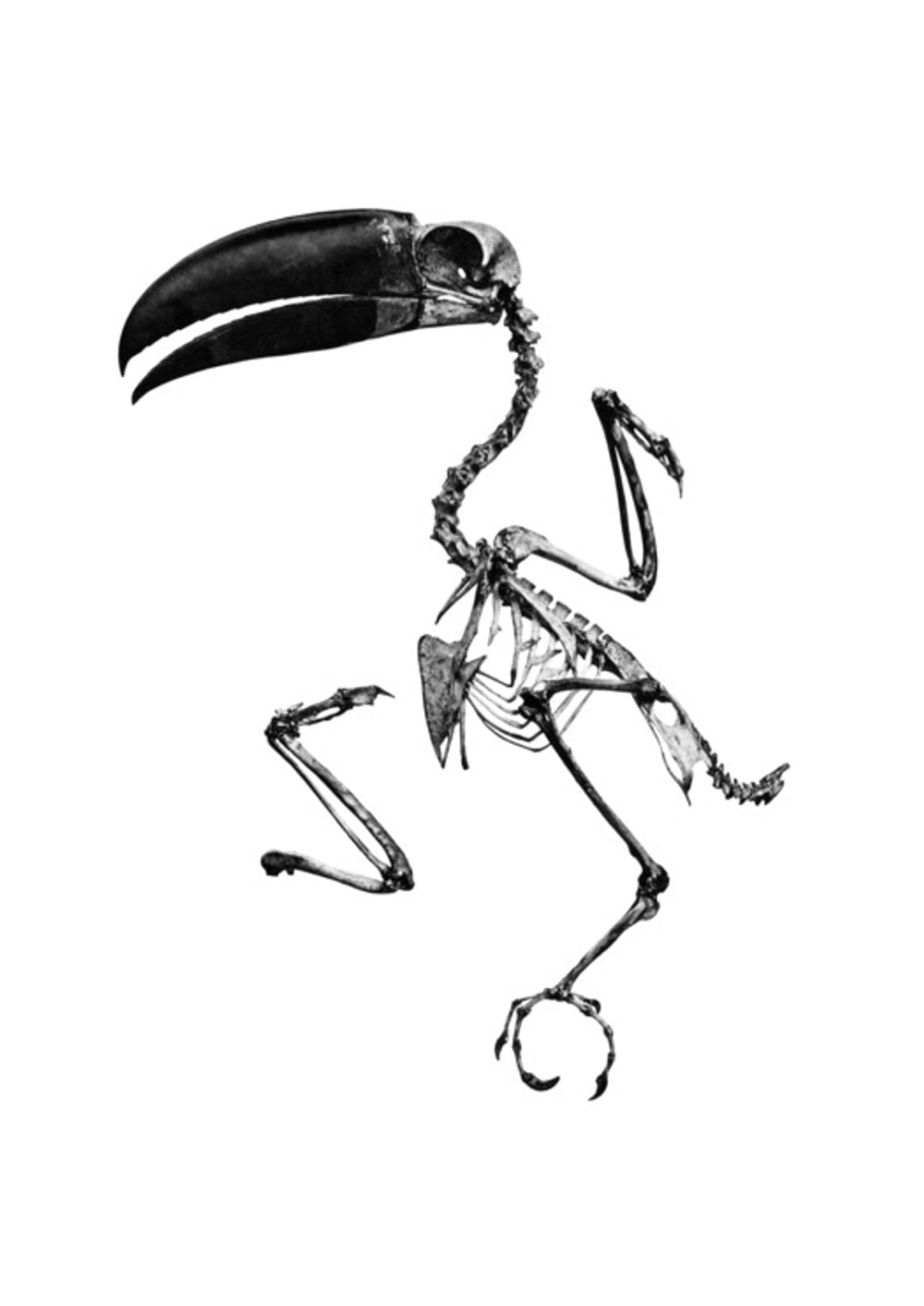 ibs