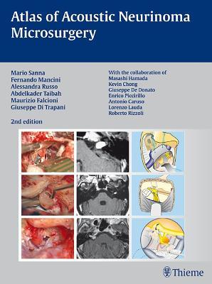 Atlas of Acoustic Neurinoma Microsurgery - Mario Sanna - cover