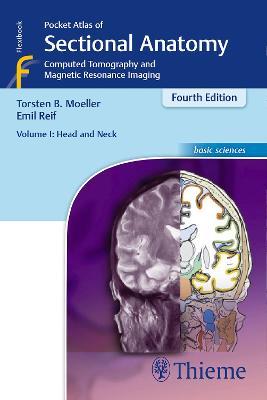 Pocket Atlas of Sectional Anatomy, Volume I: Head and Neck: Computed Tomography and Magnetic Resonance Imaging - Torsten Bert Moeller,Emil Reif - cover