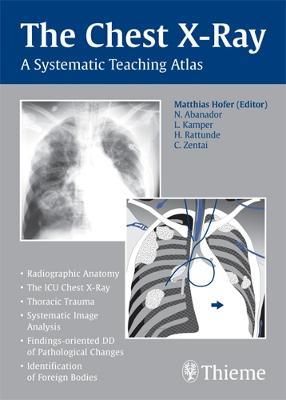 The Chest X-Ray: A Systematic Teaching Atlas - Matthias Hofer - cover
