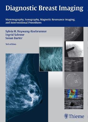 Diagnostic Breast Imaging: Mammography, Sonography, MRI and Interventional Procedures - Sylvia H. Heywang-Koebrunner,Ingrid Schreer,Susan Barter - cover