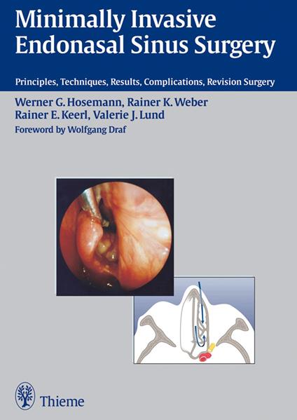 Minimally Invasive Endonasal Sinus Surgery