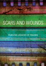 Scars and Wounds