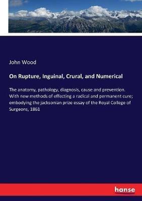On Rupture, Inguinal, Crural, and Numerical: The anatomy, pathology, diagnosis, cause and prevention. With new methods of effecting a radical and permanent cure; embodying the jacksonian prize essay of the Royal College of Surgeons, 1861 - John Wood - cover