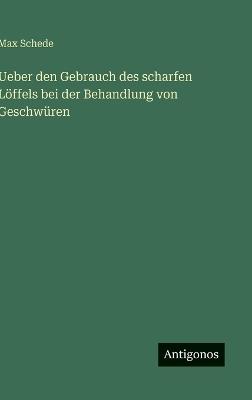 Ueber den Gebrauch des scharfen Löffels bei der Behandlung von Geschwüren - Max Schede - cover