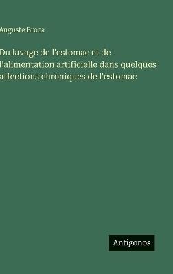 Du lavage de l'estomac et de l'alimentation artificielle dans quelques affections chroniques de l'estomac - Auguste Broca - cover