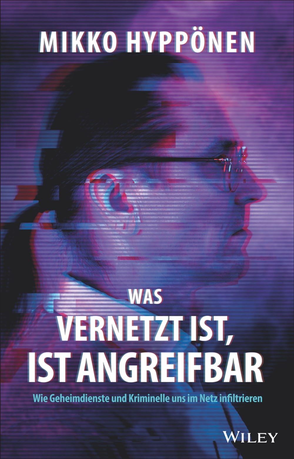 ibs
