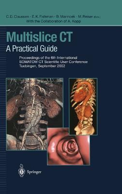 Multislice: A Practical Guide - Claus Claussen,Elliot K. Fishman,Borut Marincek - cover