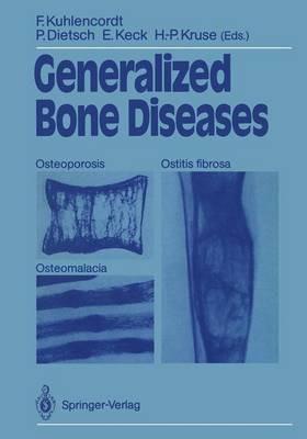 Generalized Bone Diseases: Osteoporosis Osteomalacia Ostitis fibrosa - cover