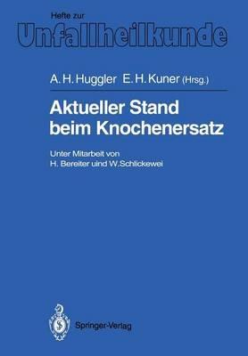 Aktueller Stand beim Knochenersatz - cover
