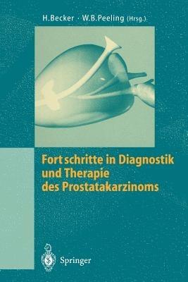 Fortschritte in Diagnostik und Therapie des Prostatakarzinoms - cover