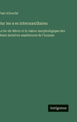 ibs