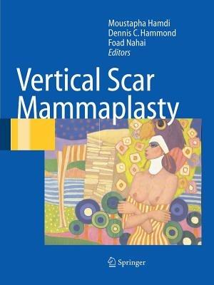 Vertical Scar Mammaplasty - cover