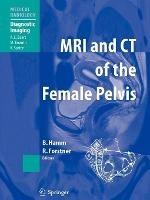 MRI and CT of the Female Pelvis - cover