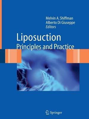 Liposuction: Principles and Practice - cover
