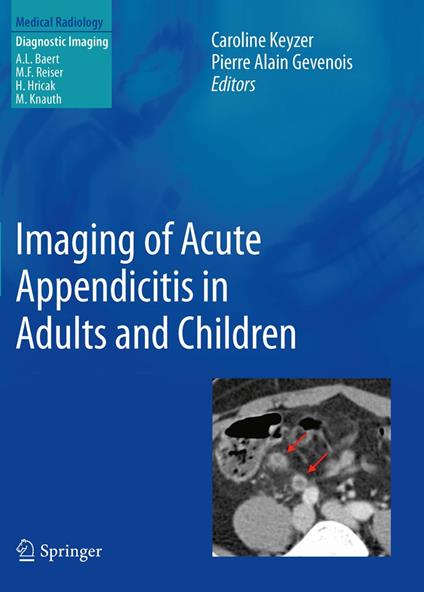 Imaging of Acute Appendicitis in Adults and Children