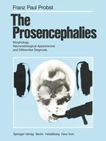 The Prosencephalies