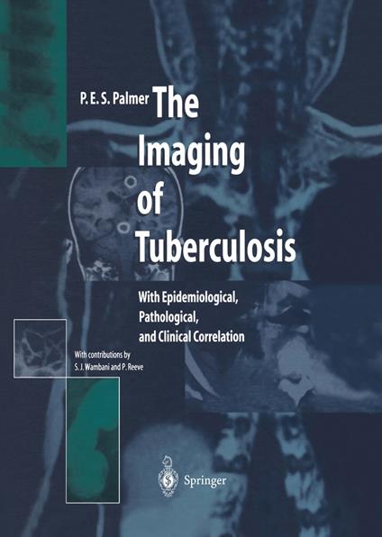 The Imaging of Tuberculosis