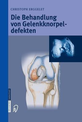 Die Behandlung von Gelenkknorpeldefekten - Christoph Erggelet - cover