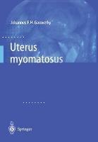 Uterus myomatosus
