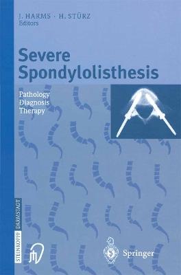 Severe Spondylolisthesis: Pathology - Diagnosis - Therapy - cover