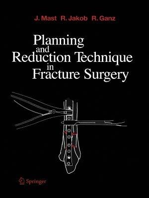 Planning and Reduction Technique in Fracture Surgery - Jeffrey Mast,Roland Jakob,Reinhold Ganz - cover
