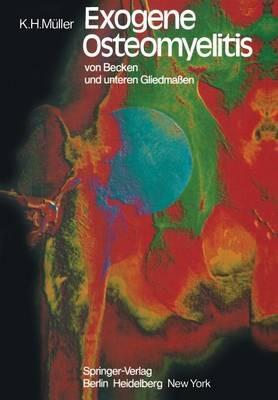 Exogene Osteomyelitis von Becken und unteren Gliedmaßen: Besonderheiten Pathogenese Klinik Therapie Ergebnisse - K.H. Müller - cover