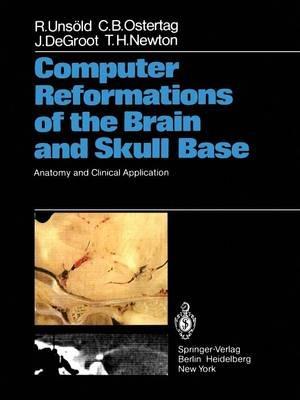Computer Reformations of the Brain and Skull Base: Anatomy and Clinical Application - Renate Unsold,C.B. Ostertag,J. DeGroot - cover