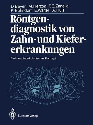 Röntgendiagnostik von Zahn- und Kiefererkrankungen: Ein klinisch-radiologisches Konzept - Dieter Beyer,Michael Herzog,Friedhelm Zanella - cover