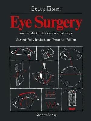 Eye Surgery: An Introduction to Operative Technique - Georg Eisner - cover