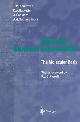 Allergic Contact Dermatitis: The Molecular Basis - cover