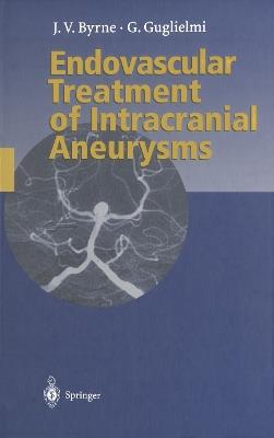 Endovascular Treatment of Intracranial Aneurysms - James Byrne,Guido Guglielmi - cover