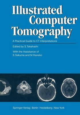Illustrated Computer Tomography: A Practical Guide to CT Interpretations - cover