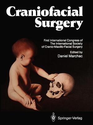 Craniofacial Surgery: Proceedings of the First International Congress of The International Society of Cranio-Maxillo-Facial Surgery. President: Paul Tessier. Cannes-La Napoule, 1985 - cover