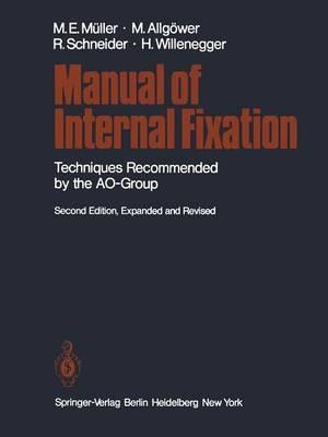 Manual of Internal Fixation: Techniques Recommended by the AO Group - Maurice E. Müller,Martin Allgöwer,Robert Schneider - cover