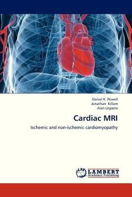 Cardiac MRI - Powell Daniel K,Killam Jonathan,Legasto Alan - cover