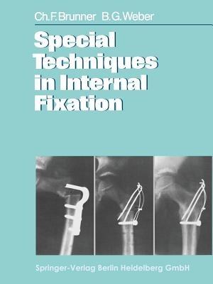 Special Techniques in Internal Fixation - C. F. Brunner,B. G. Weber - cover