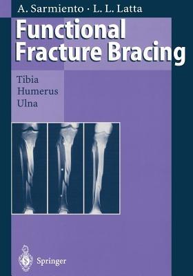 Functional Fracture Bracing: Tibia, Humerus, and Ulna - Augusto Sarmiento,Loren L. Latta - cover