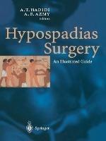 Hypospadias Surgery: An Illustrated Guide - cover