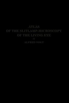 Atlas of the Slitlamp-Microscopy of the Living Eye: Technic and Methods of Examination - Alfred Vogt,Robert Von Der Heydt - cover