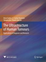 The Ultrastructure of Human Tumours: Applications in Diagnosis and Research - Brian Eyden,S. Sankar Banerjee,Yongxin Ru - cover