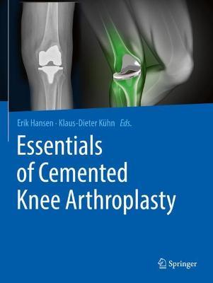 Essentials of Cemented Knee Arthroplasty - cover