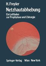 Netzhautabhebung: Ein Leitfaden zur Prophylaxe und Chirurgie