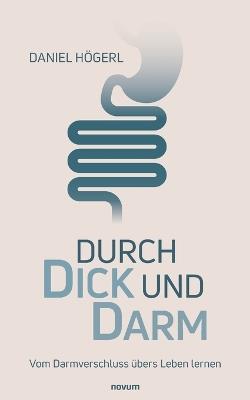 Durch Dick und Darm: Vom Darmverschluss übers Leben lernen - Daniel Högerl - cover