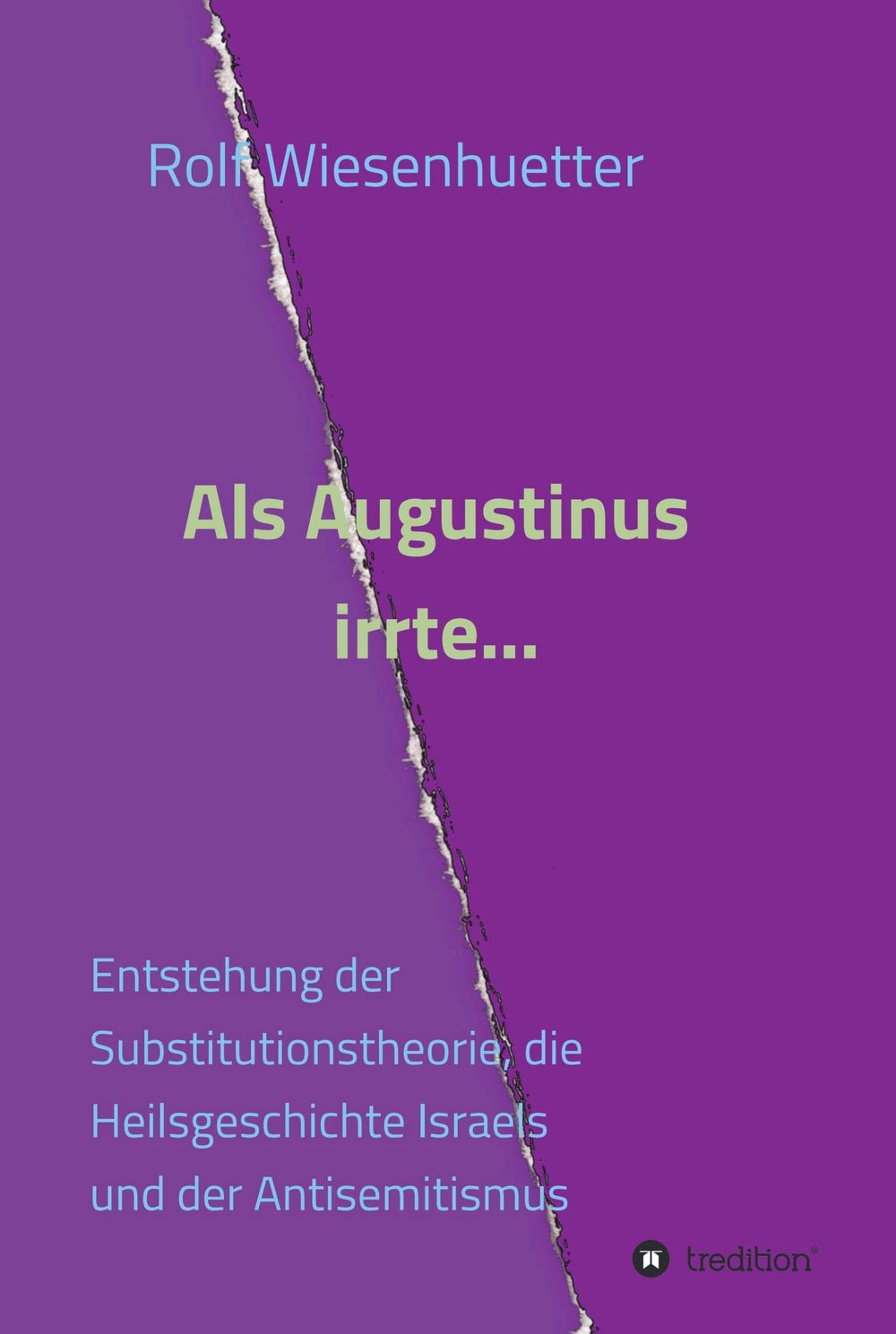 ibs